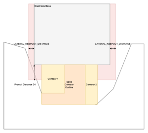 Platzierung der Basis mit Anwendung der Option nach Schritten 1-3