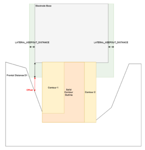 Placement of the base with application of the option according to step 4